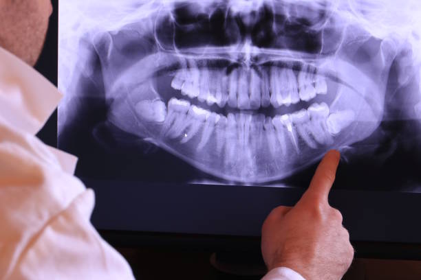 Best Emergency TMJ Treatment in Siloam Springs, AR