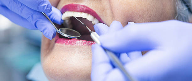 Best Urgent Care for Lost Fillings or Crowns in Siloam Springs, AR